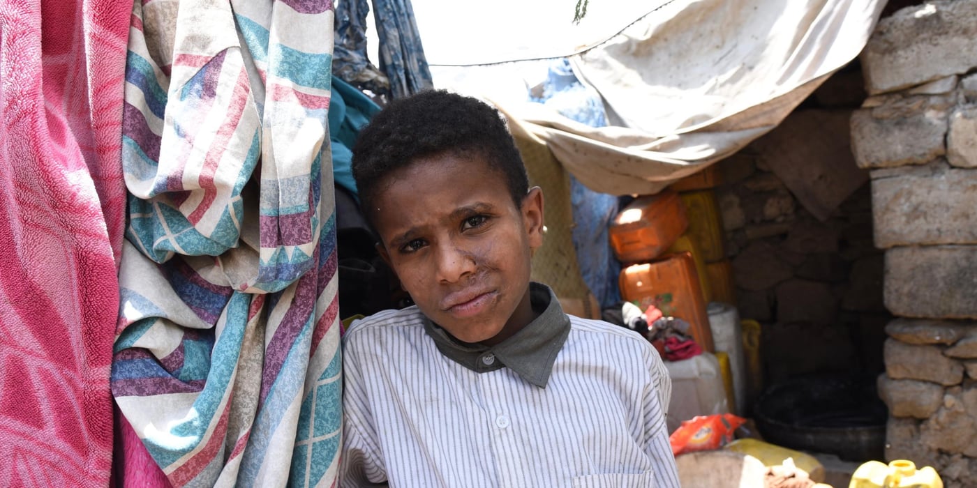 Muhannad (10)  became sick with cholera before the family was forcibly displaced from their home town of Taizz 8 months ago. His mother Fahria said that Muhannad was so ill he was about to die. “I was so sick that I couldn’t even move because of the massive stomach pain,” Muhanad said. 

Photo: Becky Bakr Abdulla/NRC, 30 August 2018